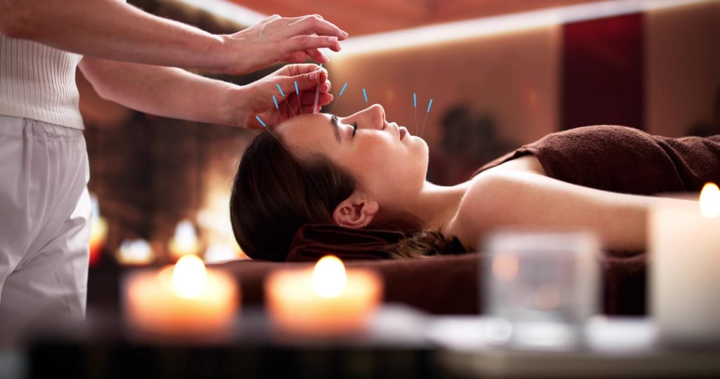 Facial acupuncture session for natural skin rejuvenation and inner balance